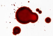 The ‘G’ list: complementary medicines with bleeding risks