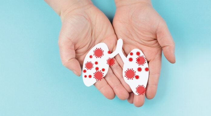 Respiratory syncytial virus: a guide for pharmacists RSV