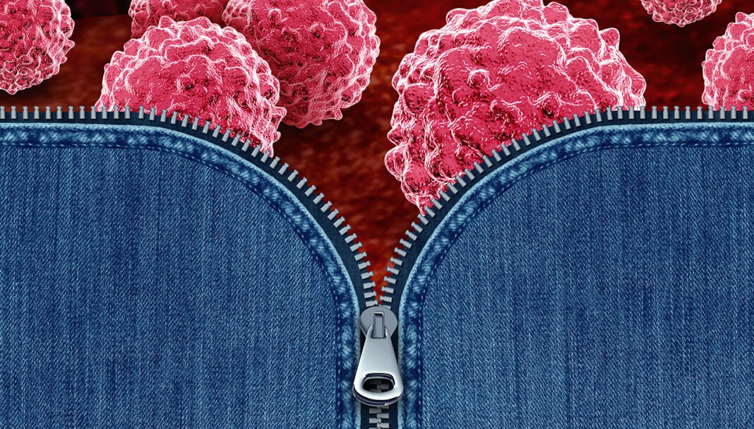 chlamydia-gonorrhoea-GettyImages-2190583915