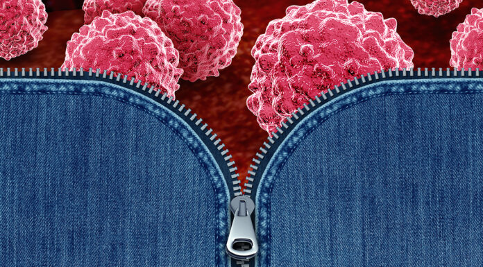 Chlamydia and gonorrhoea