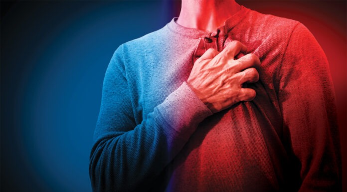 Venous thromboembolism