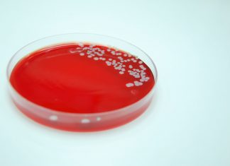 Nasal swab offers hope for reducing vancomycin use Bacterial Culture of Staphylococcus aureus