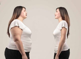 Weight management