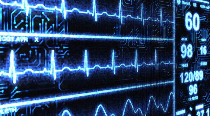 Diclofenac associated with cardiovascular health risk