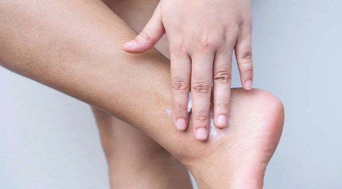 Dry skin management dry skin