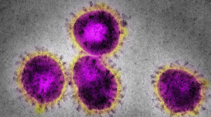 Coronavirus: Australia ‘alert but not alarmed’