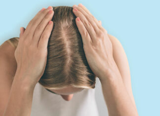 An innovative, effective OTC solution to scalp pruritus