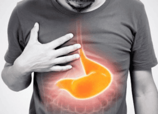 Why is my PPI not working? Individual experiencing gastroesophageal reflux symptoms, highlighting the area affected by proton pump inhibitors (PPIs).