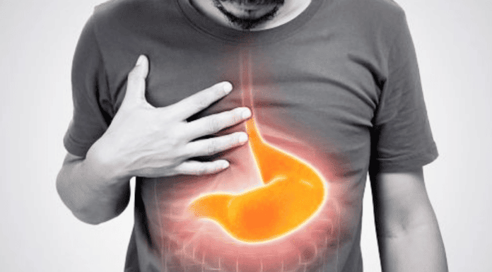 Why is my PPI not working? Individual experiencing gastroesophageal reflux symptoms, highlighting the area affected by proton pump inhibitors (PPIs).