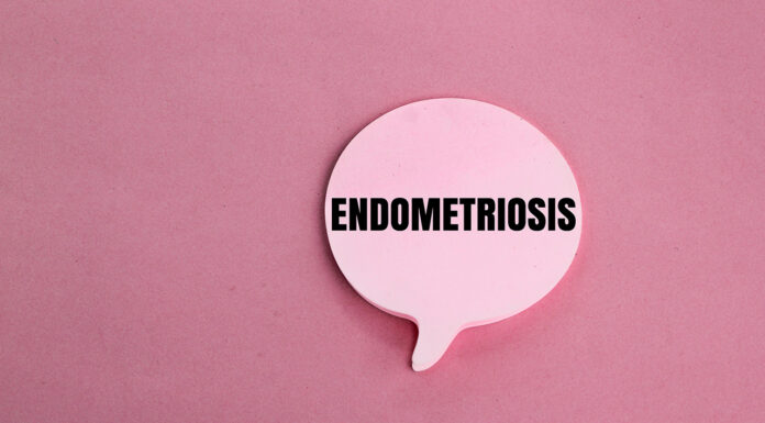 Empowering pharmacists to spot endometriosis early