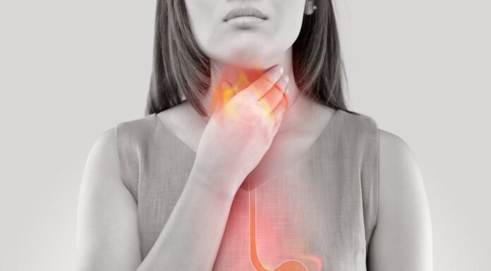 The acid test: OTC reflux and GORD management