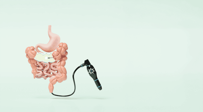 Optimising patient care in endoscopy and colonoscopy