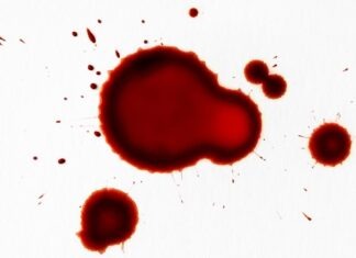 ‘G’ whiz, we’ve got a bleeder