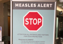 measles