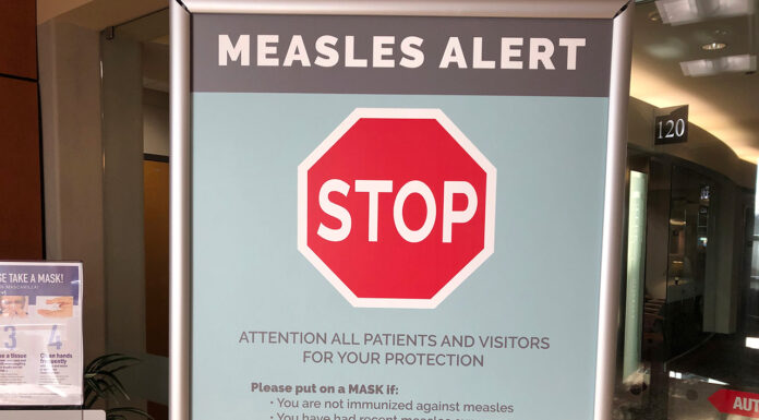measles