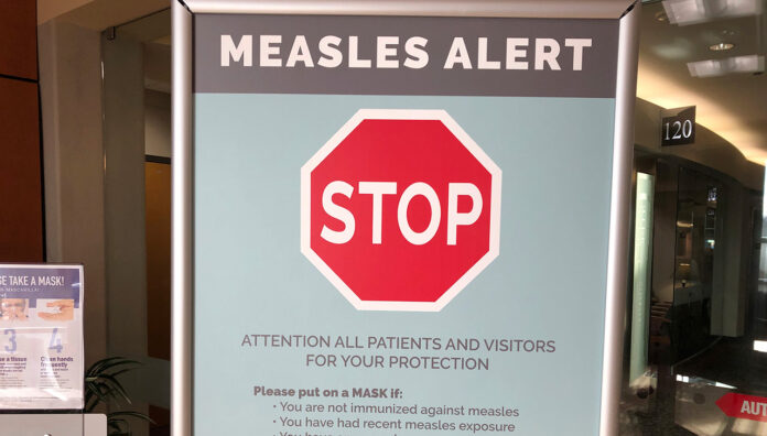 measles