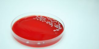 Bacterial Culture of Staphylococcus aureus