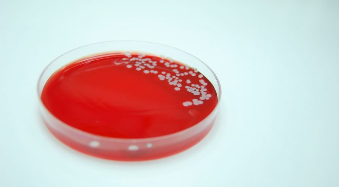 Bacterial Culture of Staphylococcus aureus