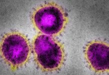 Pharmacists warned to be on alert for coronavirus infections