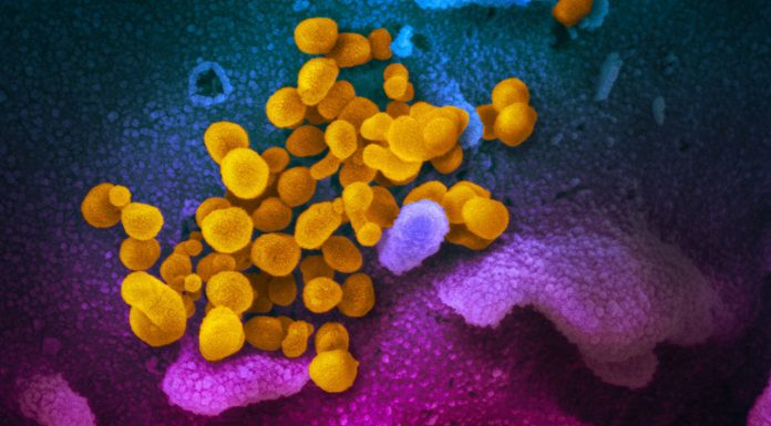 A scanning electron microscope image shows SARS-CoV-2 (yellow) – also known as 2019-nCoV, the virus that causes COVID-19 –isolated from a patient in the US, emerging from the surface of cells (blue/pink) cultured in a lab. Image: NIAID-RML