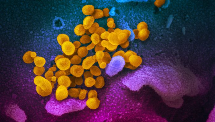 A scanning electron microscope image shows SARS-CoV-2 (yellow) – also known as 2019-nCoV, the virus that causes COVID-19 –isolated from a patient in the US, emerging from the surface of cells (blue/pink) cultured in a lab. Image: NIAID-RML