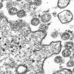 A microscopic image of an isolate from the first US case of COVID-19. Image: Centres for Disease Control and Prevention