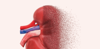 Finding the missing millions with CKD