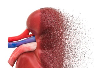 Finding the missing millions with CKD