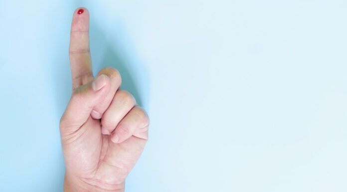 Screening for kidney disease starts in pharmacy chronic kidney disease