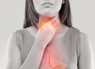 The acid test: OTC reflux and GORD management