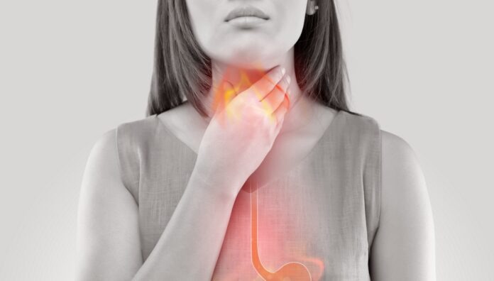 GettyImages-880723156